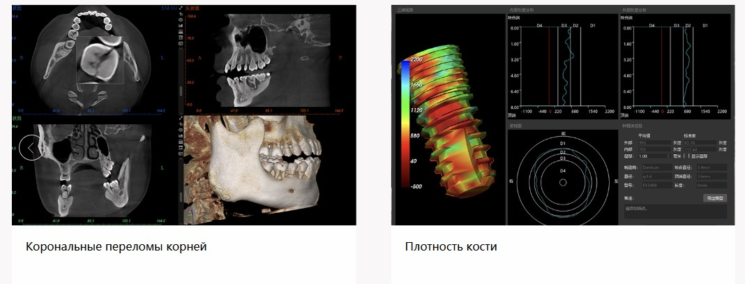 Библиотека имплантов и планирование операций